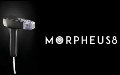 Morpheus8: cos’è e come funziona il trattamento estetico rivoluzionario