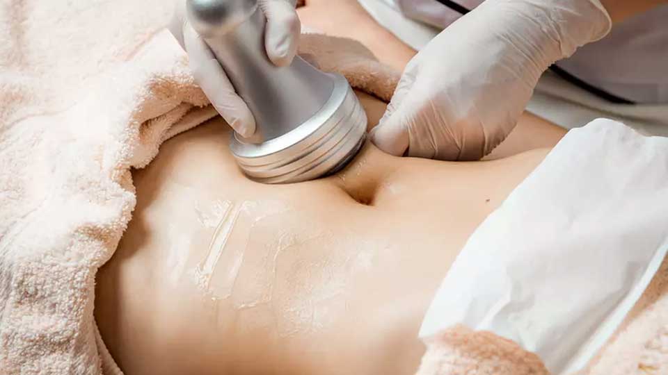 La liposuzione ad ultrasuoni: una tecnica innovativa per eliminare il grasso in eccesso