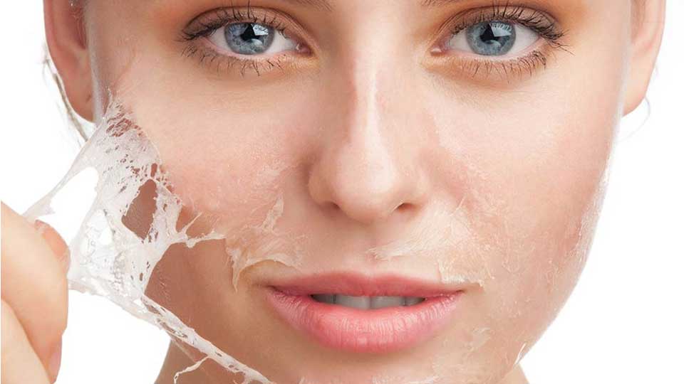 Il peeling chimico: tutto quello che c’è da sapere sulla procedura di ringiovanimento della pelle