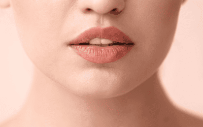Cheiloplastica per labbra perfette