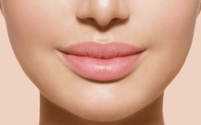 Lip Lift: cos’è, come si fa e quali sono i vantaggi estetici e funzionali