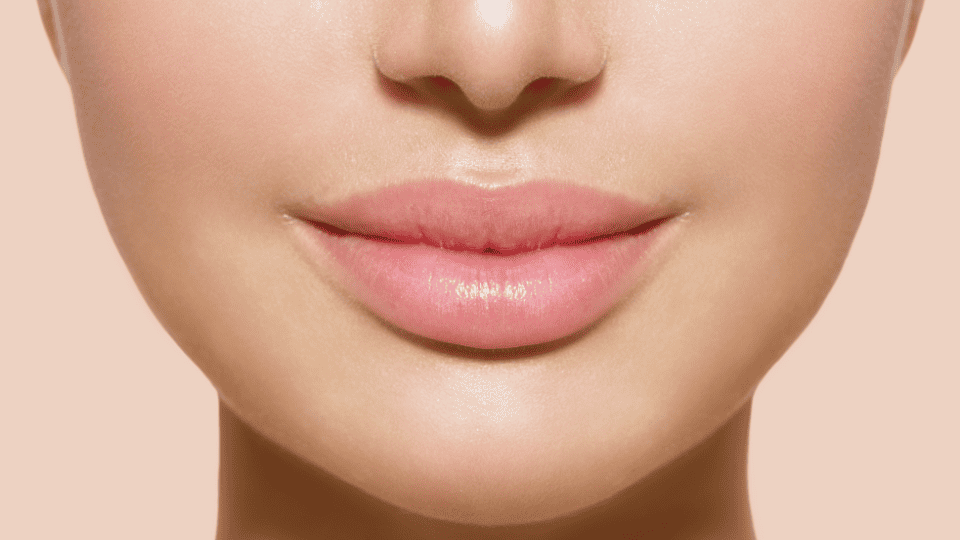 Lip Lift quali sono i vantaggi per avere labbra più carnose